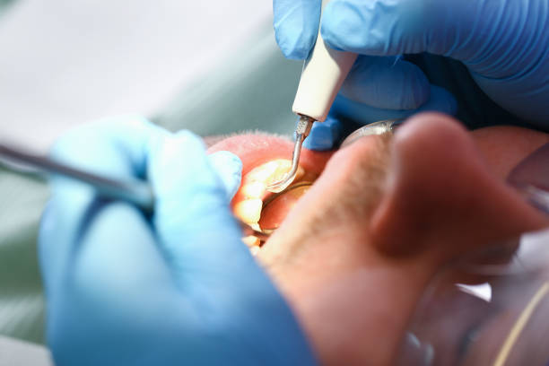 Best Broken or Chipped Tooth Repair in Coleman, TX