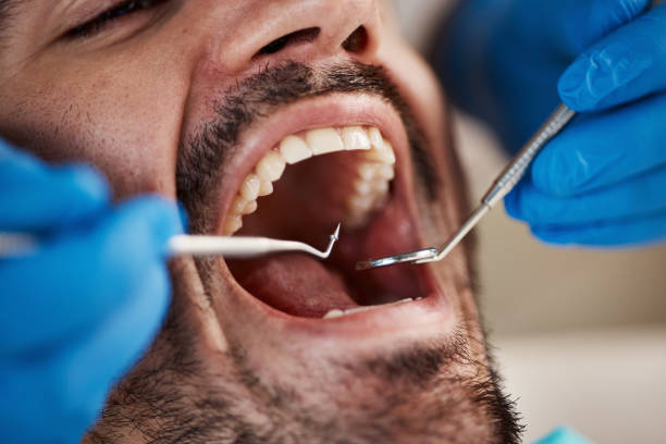 Best Emergency Dental Care for Sports Injuries in Coleman, TX