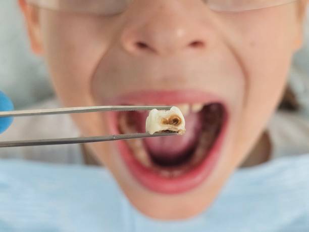 Best Emergency Care for Gum Disease in Coleman, TX