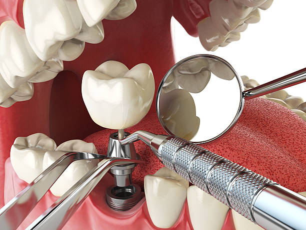 Best Walk-In Emergency Dental Services in Coleman, TX